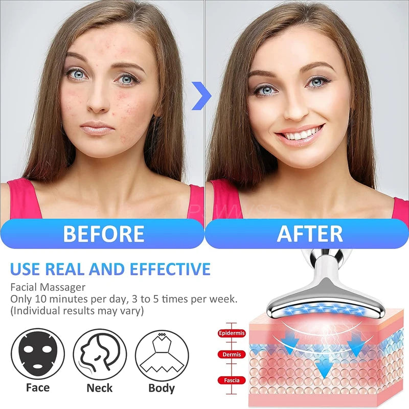 Face Lifting Device