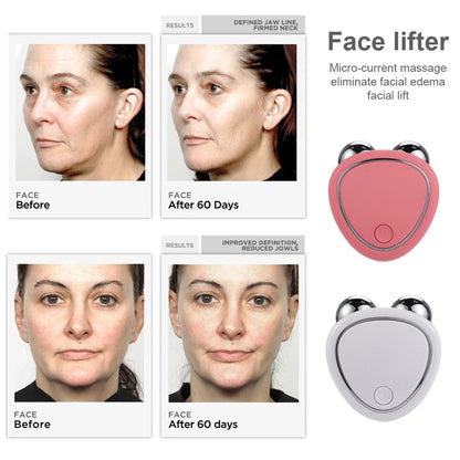 EMS Face Lifting Device